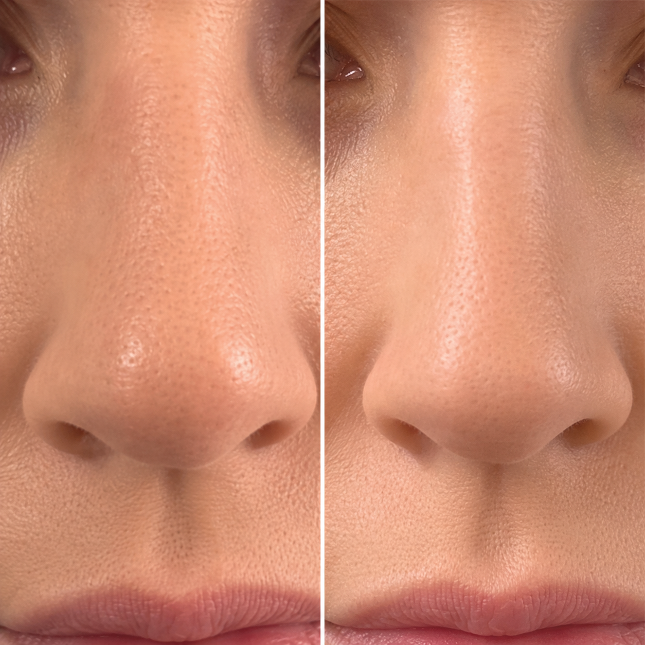 Wyona Glow Nose Sculpt - Elektrischer Beauty Nasenclip
