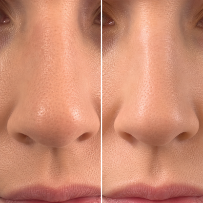 Wyona Glow Nose Sculpt - Elektrischer Beauty Nasenclip
